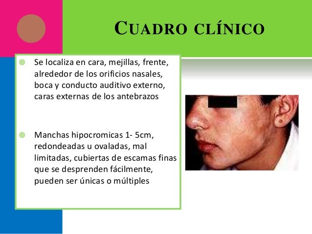 discromias cutaneas